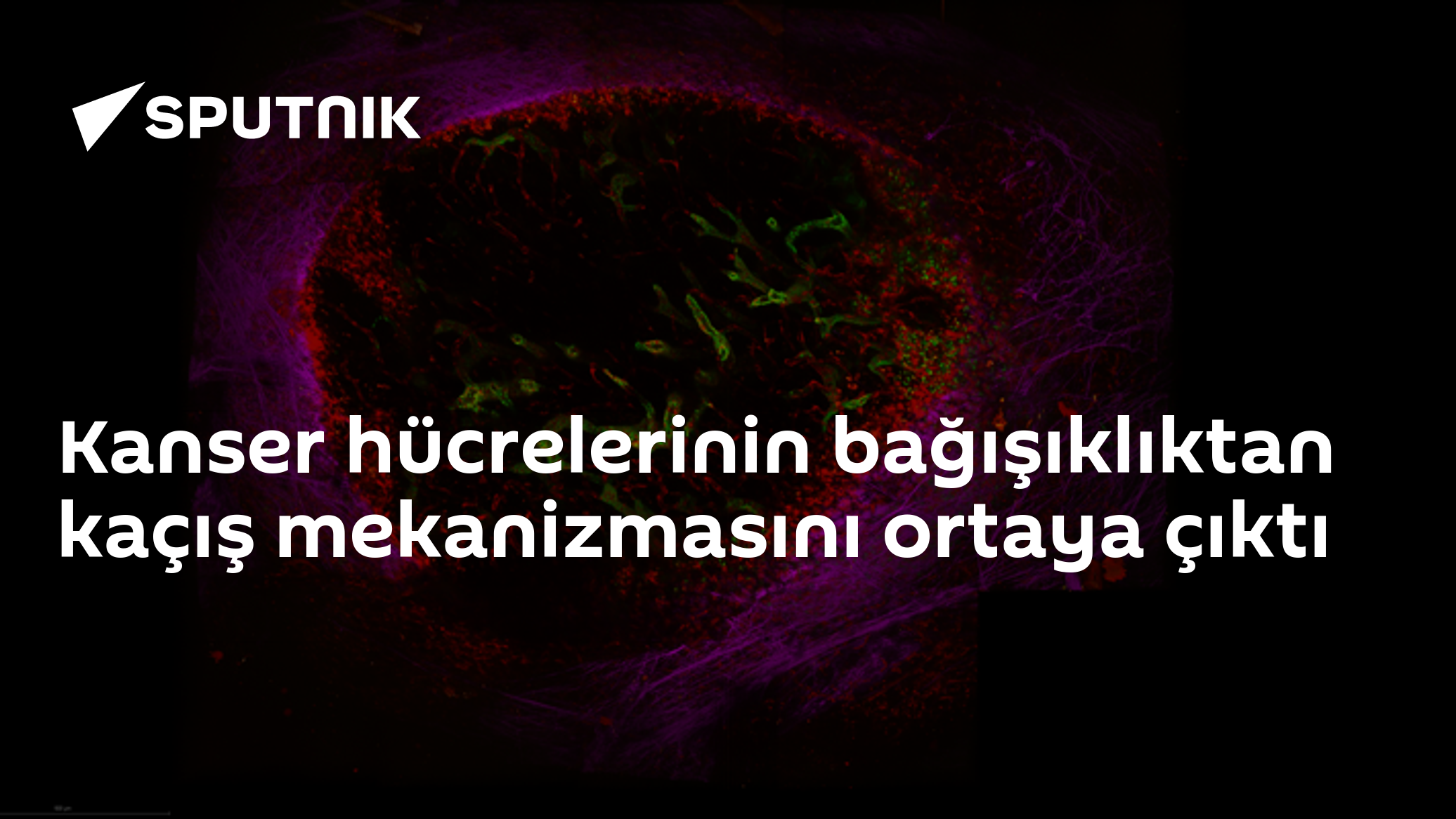 Kanser hücrelerinin bağışıklıktan kaçış mekanizmasını ortaya çıktı