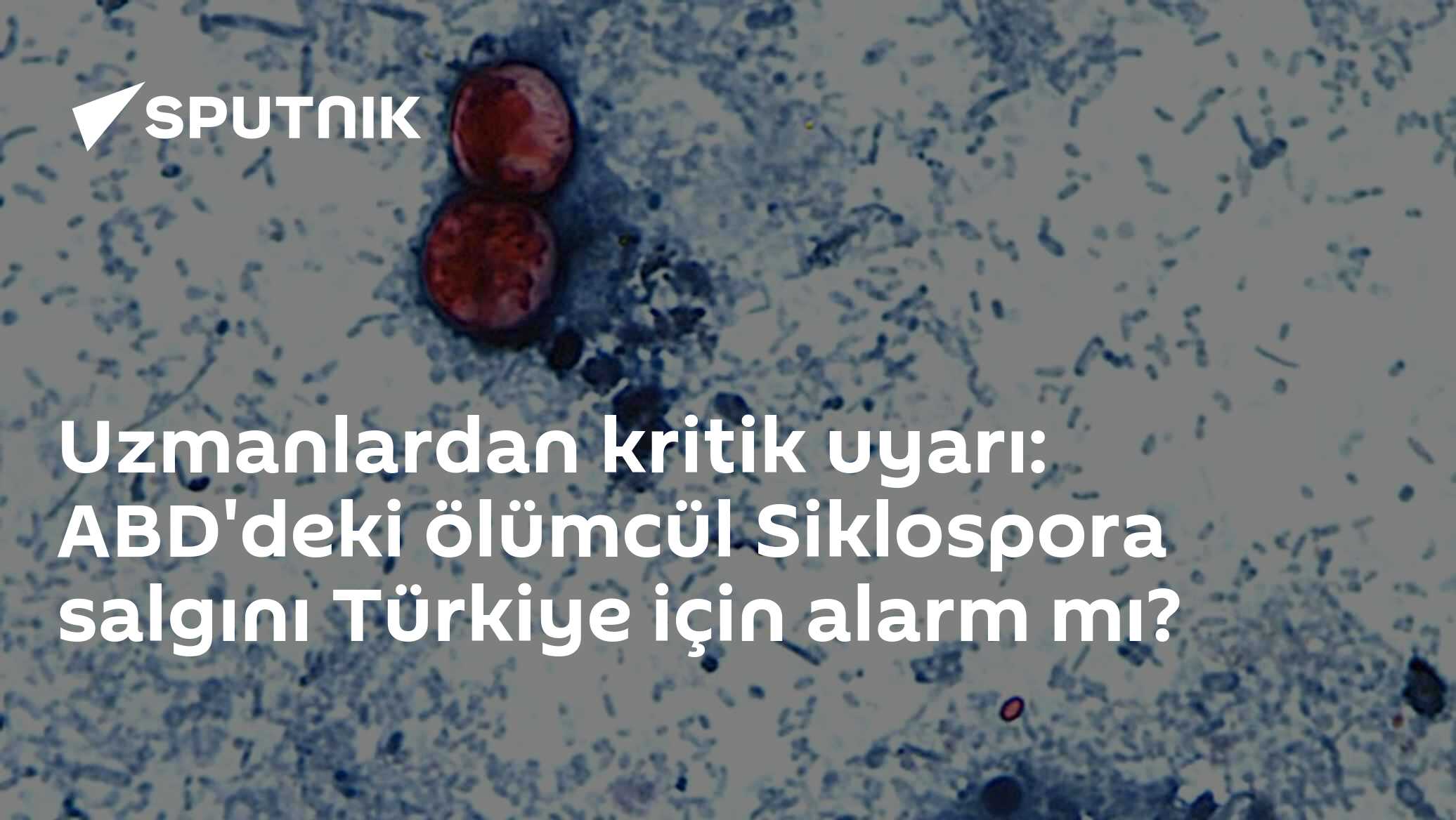 Uzmanlardan kritik uyarı: ABD'deki ölümcül Siklospora salgını Türkiye için alarm mı?