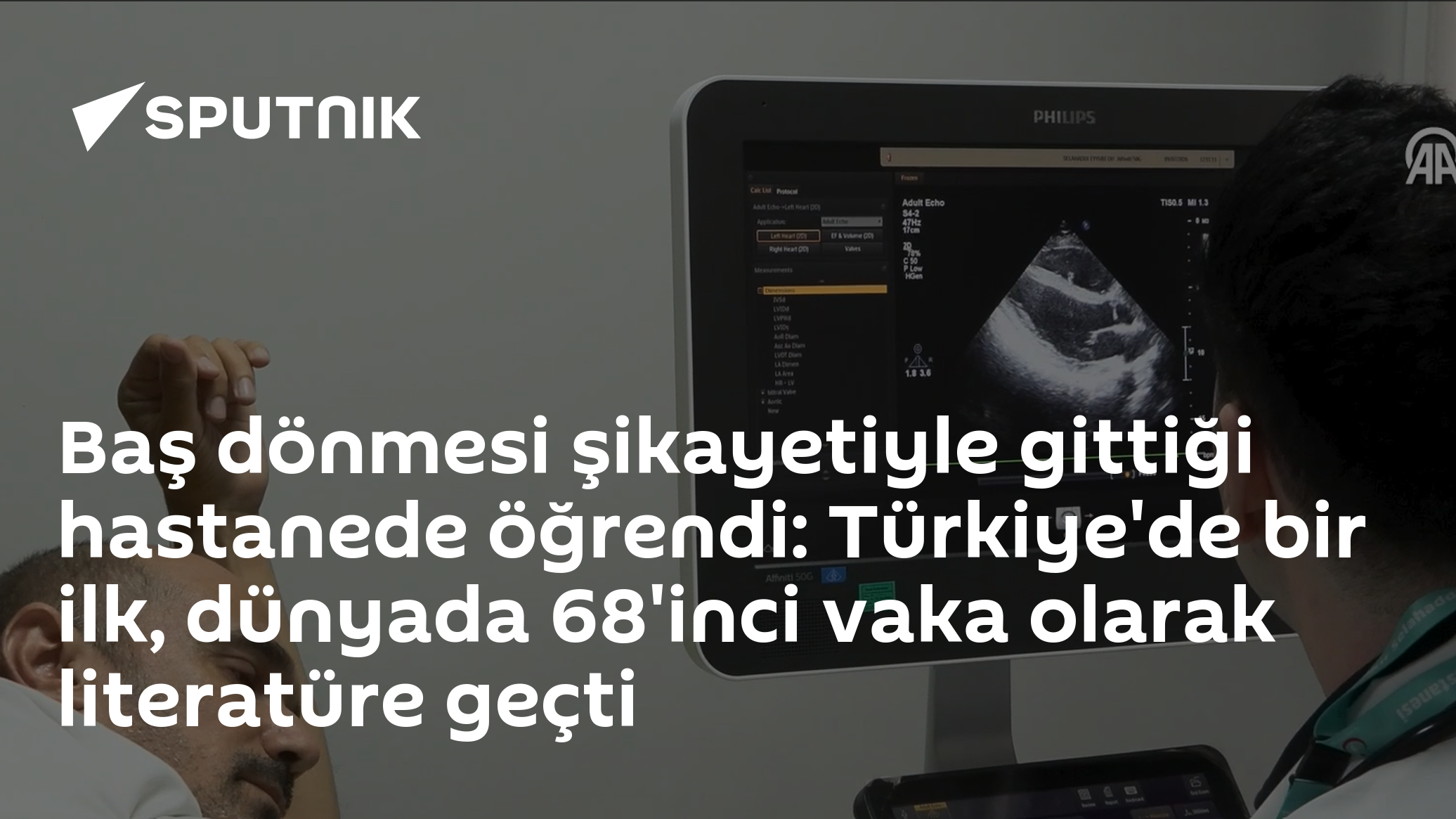 Baş dönmesi şikayetiyle gittiği hastanede öğrendi: Türkiye'de bir ilk, dünyada 68'inci vaka olarak literatüre geçti