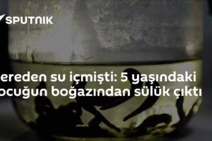 Dereden su içmişti: 5 yaşındaki çocuğun boğazından sülük çıktı