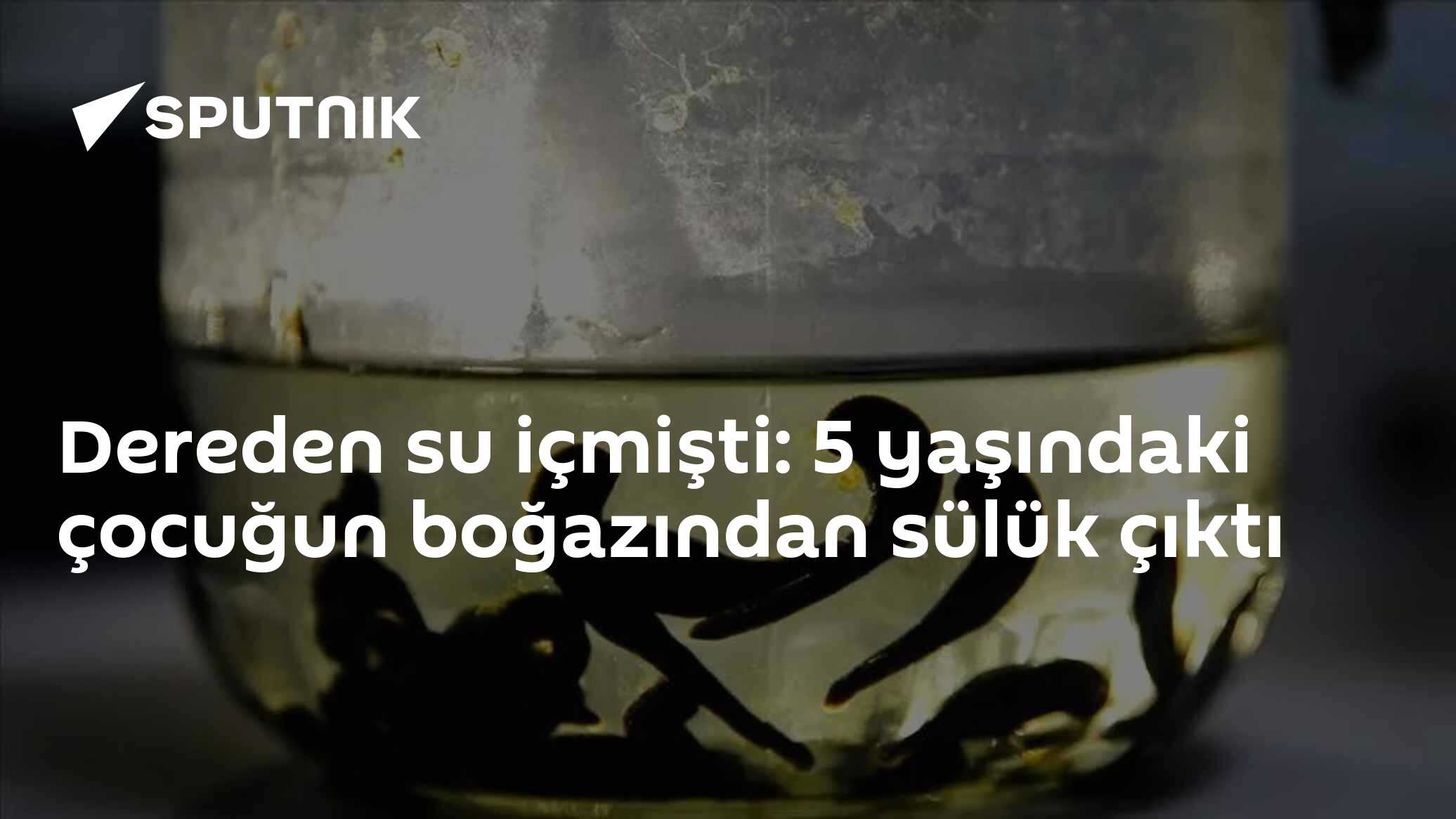 Dereden su içmişti: 5 yaşındaki çocuğun boğazından sülük çıktı