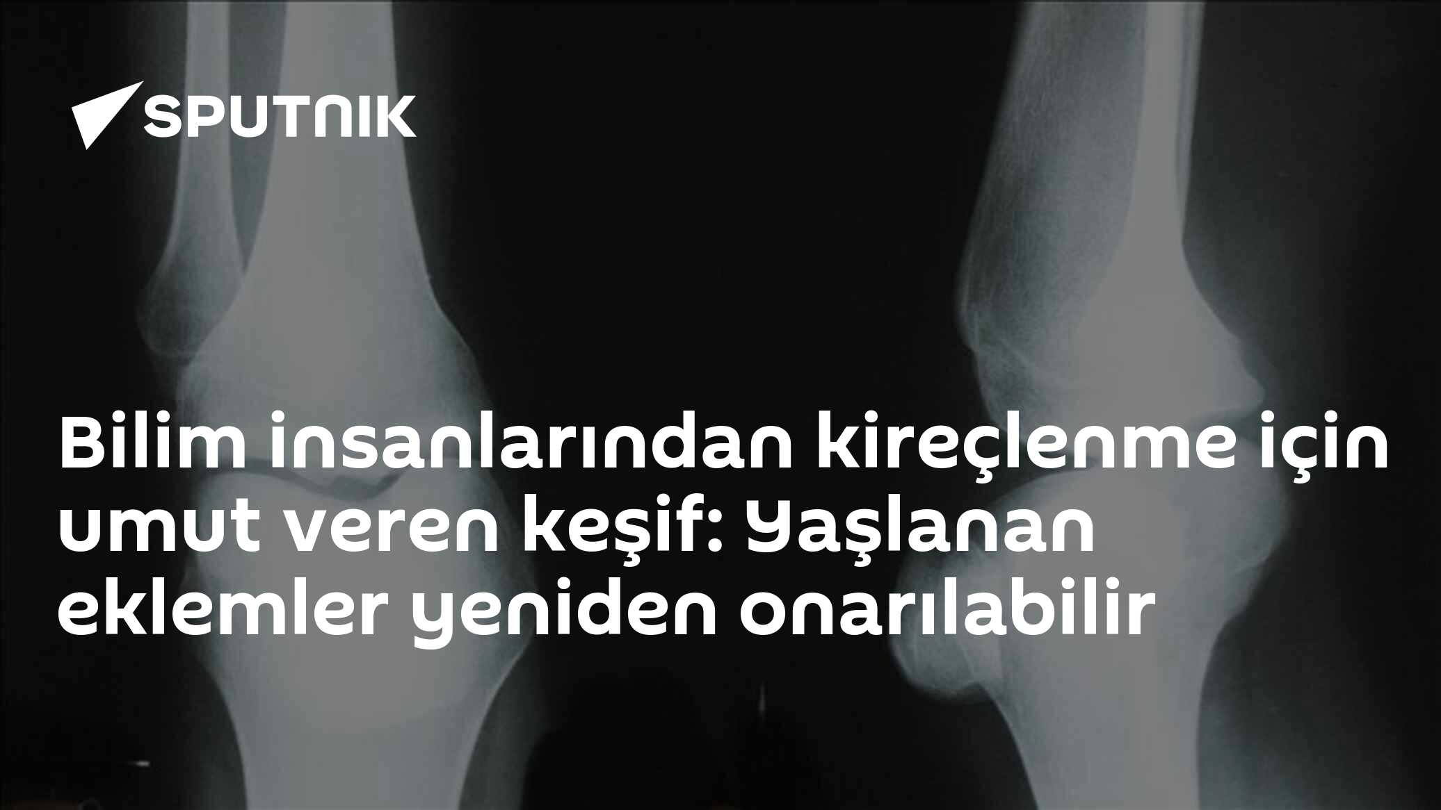 Bilim insanlarından kireçlenme için umut veren keşif: Yaşlanan eklemler yeniden onarılabilir