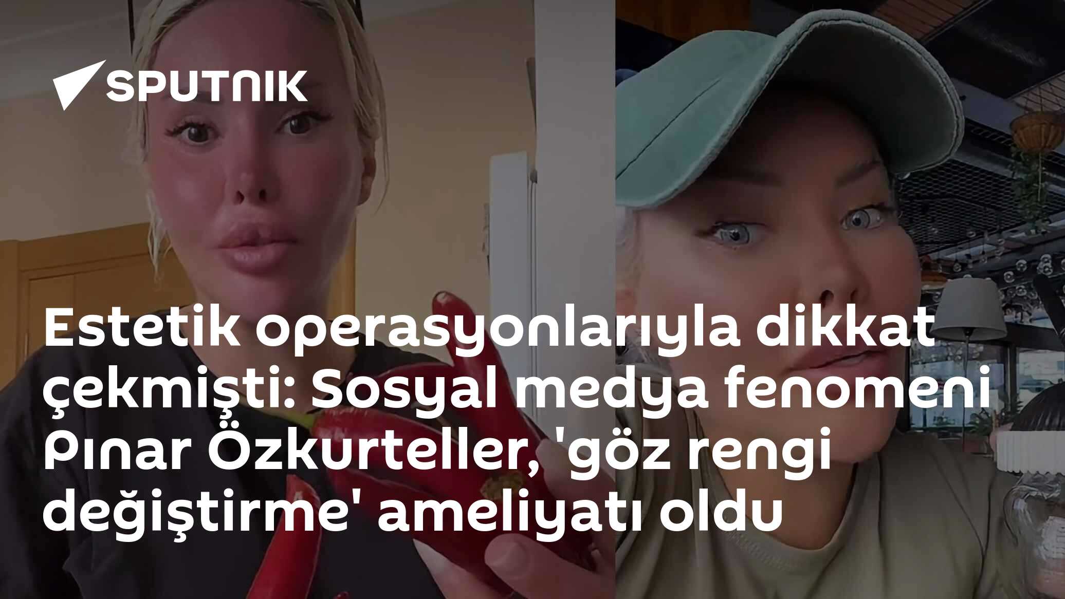 Estetik operasyonlarıyla dikkat çekmişti: Sosyal medya fenomeni Pınar Özkurteller, 'göz rengi değiştirme' ameliyatı oldu