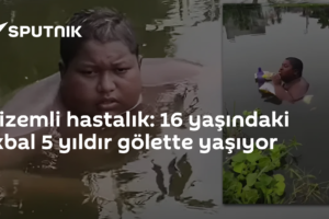 Gizemli hastalık: 16 yaşındaki̇ İkbal 5 yıldır gölette yaşıyor