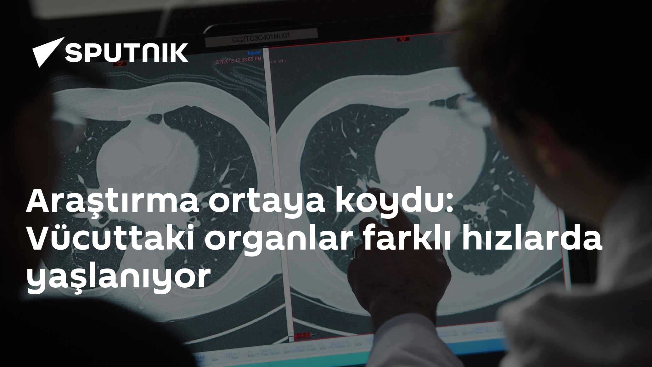 Araştırma ortaya koydu: Vücuttaki organlar farklı hızlarda yaşlanıyor