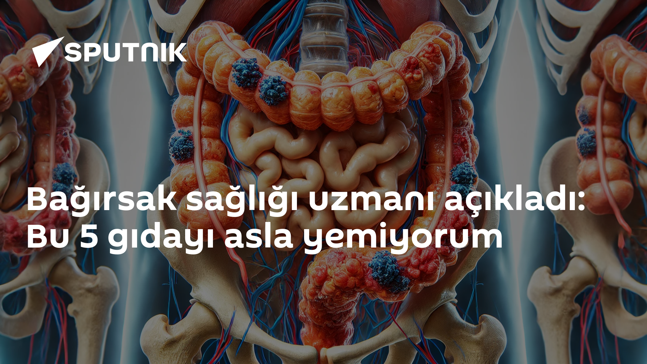 Bağırsak sağlığı uzmanı açıkladı: Bu 5 gıdayı asla yemiyorum