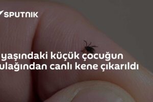 5 yaşındaki küçük çocuğun kulağından canlı kene çıkarıldı