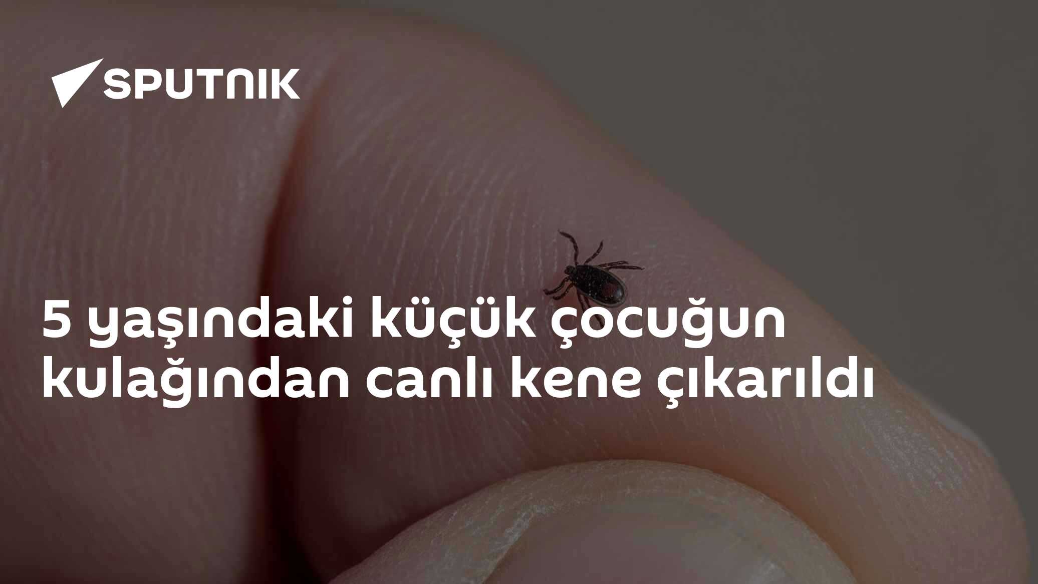 5 yaşındaki küçük çocuğun kulağından canlı kene çıkarıldı