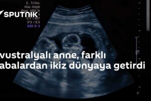 Avustralyalı anne, farklı babalardan ikiz dünyaya getirdi