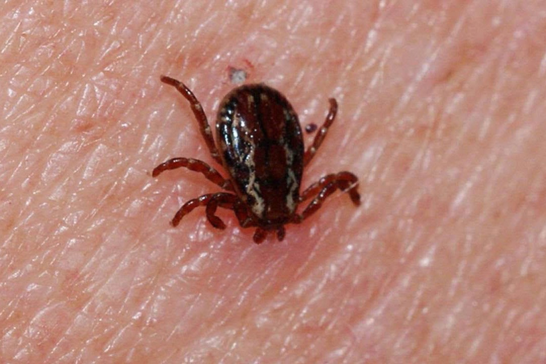 Sivas'ta KKKA şüphesiyle tedavi gören kadın hayatını kaybetti