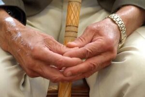 Parkinson hastalığı