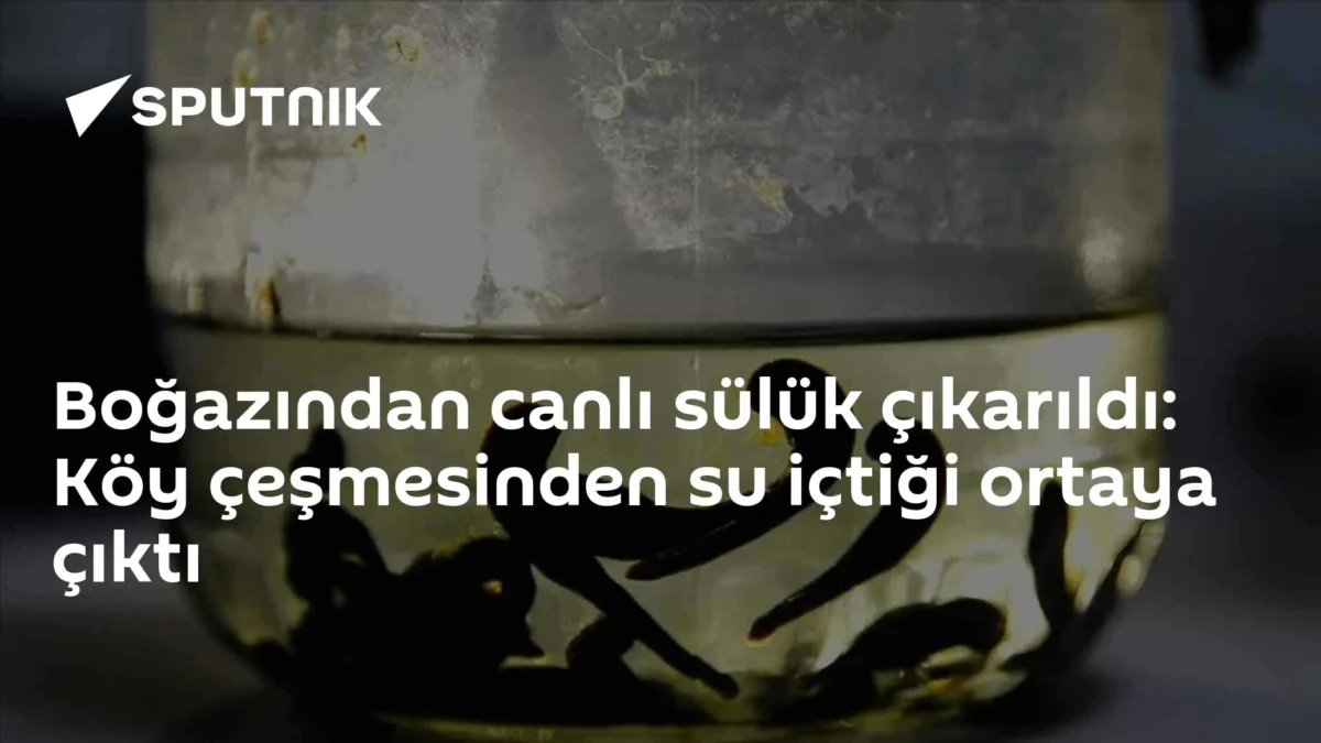 Boğazından canlı sülük çıkarıldı: Köy çeşmesinden su içtiği ortaya çıktı