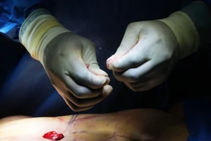 Tayland'da penis dolgusu yaptıran İngiliz sosyal medya fenomeni öldü: Soruşturma başlatıldı