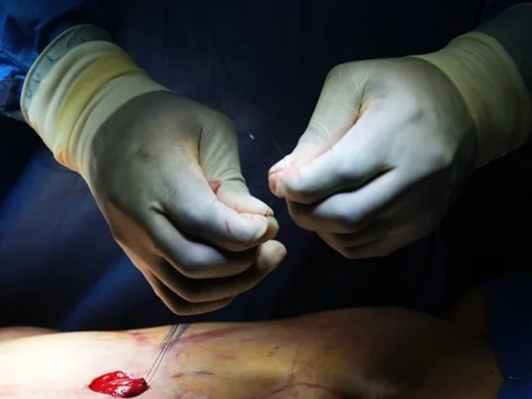 Tayland'da penis dolgusu yaptıran İngiliz sosyal medya fenomeni öldü: Soruşturma başlatıldı