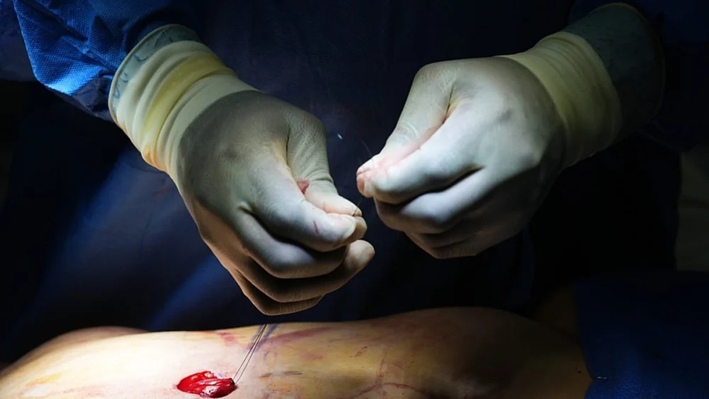 Tayland'da penis dolgusu yaptıran İngiliz sosyal medya fenomeni öldü: Soruşturma başlatıldı