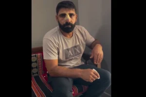 Bayburt’ta Amedspor forması gieyen Kürt inşaat işçilerini darp ettiler, burnu beş yerinden krıldı