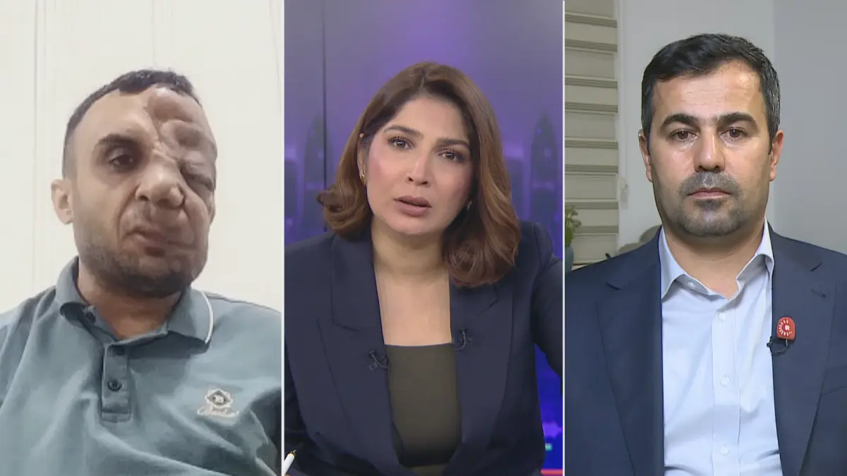 8 kez ameliyat oldu, hastalık yeniden yüzünü sardı: Miran yardım bekliyor