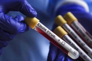 Kongo'da Ebola vakası sayısı 8 bini aştı